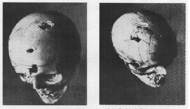 Останки убитых в Катынском лесу