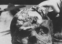 Осмотр останков